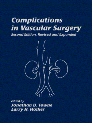 cover image of Complications in Vascular Surgery